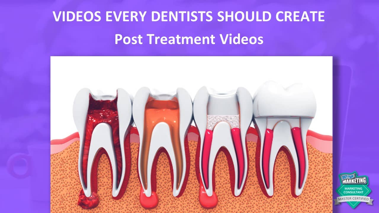 post-treatment videos are very helpful for patients recovering from dental treatment